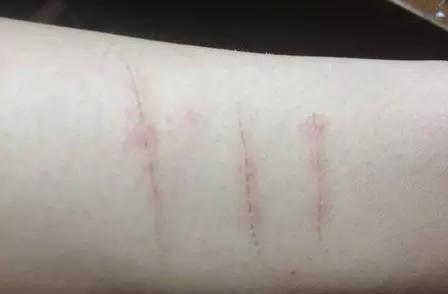 一熊孩子玩水管反被水管卡住,福建三明熊小孩