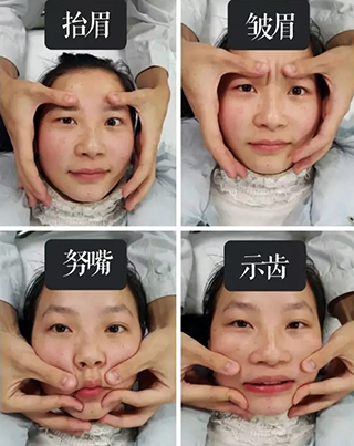 歪嘴改善动作,歪嘴巴治疗方法图片视频播放