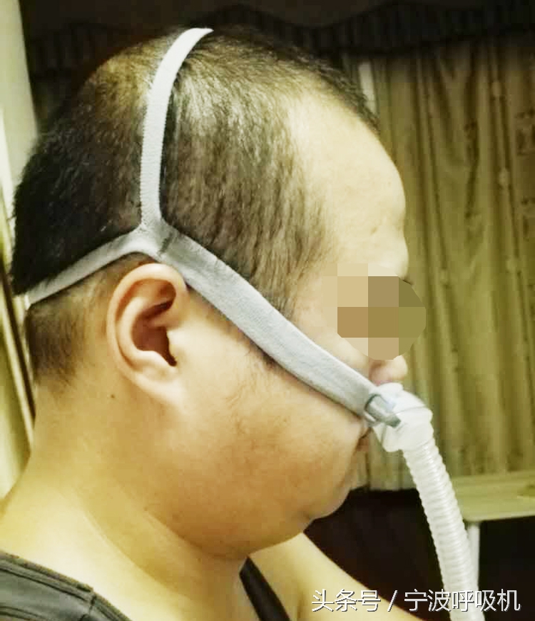 瑞思迈呼吸机面罩,瑞思迈airsense10呼吸机鼻罩