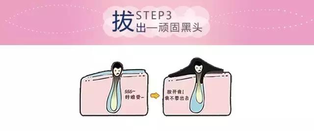 去黑头的方法你真的对了吗,去黑头的最好方法科普