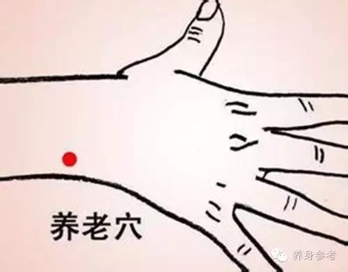 董氏奇穴治疗偏头痛,生小孩神经痛针灸