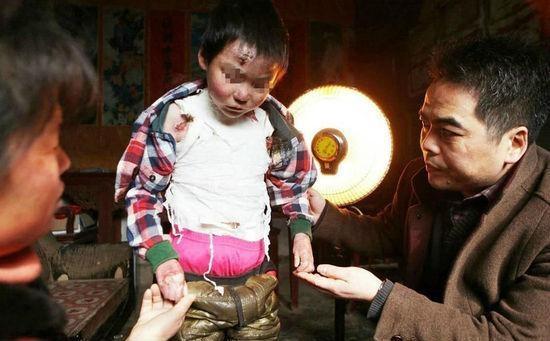 8岁男孩身患怪病,男孩患怪病的真实案例