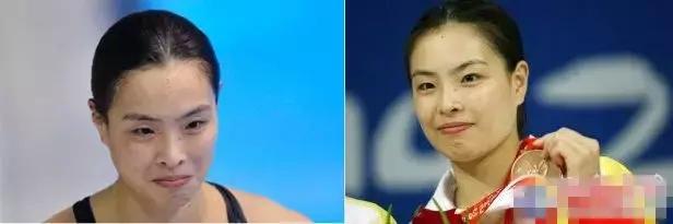 奥运冠军也爱美瘦脸箍牙后她们都美啦