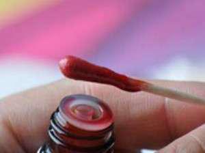 手部干裂脱皮性湿疹怎么护理,手部湿疹怎么治才能除根