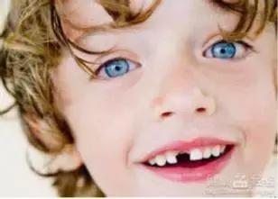 乳牙外伤正确处理方法,幼儿乳牙受到外伤发黑怎么治疗