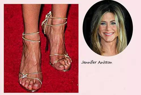 你的脚丫配得上新买的凉鞋吗?美足保养请戳这里