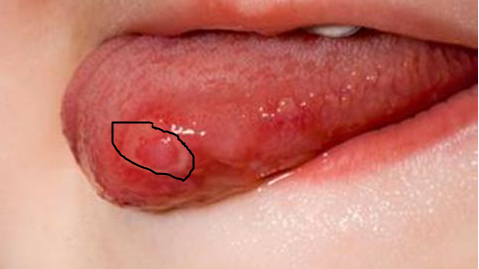 舌头别舔这里，小动作却会诱发大疾病！