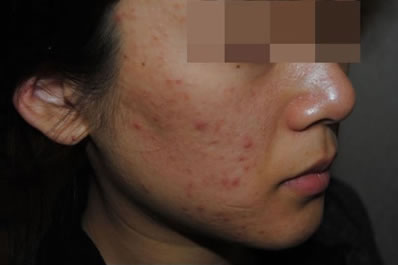 什么品牌的祛皱产品好,什么牌子的祛痘产品效果最好