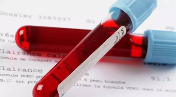 医院里面需要空腹做检查的是哪些,去医院需要空腹检查的项目有哪些