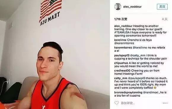 作为一个有同样爱好的老陕我必须提醒菲尔普斯:拔罐后不能下水！