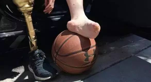 卫生棉会引发炎症吗,卫生棉中毒死亡事件