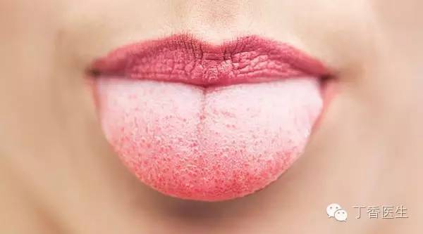 一张舌头看出几个健康问题,舌头上的健康状况图解