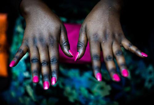 非洲人以白为美？花重金全身漂白比整容还疯狂！