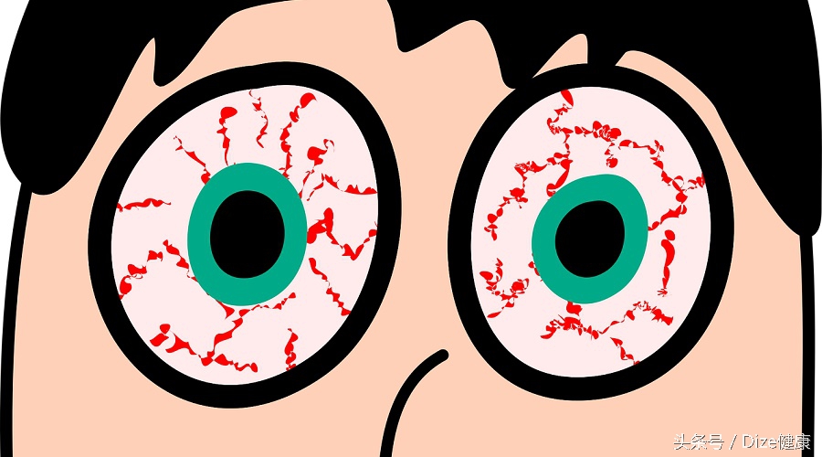 隐形眼镜戴久了干涩怎么解决,隐形眼镜戴久了干涩用什么药