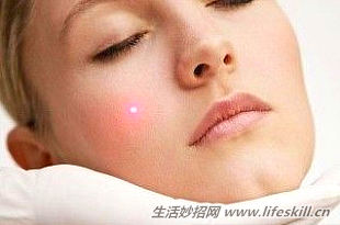 激光点痣掉痂正常过程,激光点痣有什么注意事项