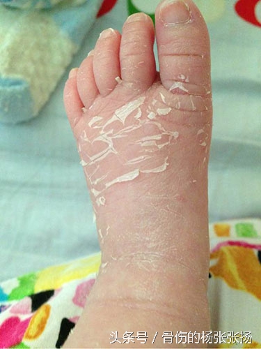 如何护理好宝宝的皮肤,怎么给宝宝身体保湿护肤呢