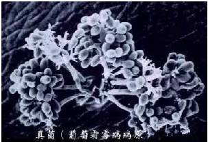 热起来全身痒,身上一捂热就痒怎么办