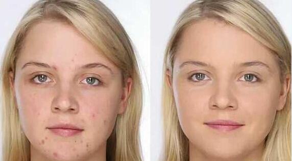 美妆品牌遮瑕膏排行榜,美妆教程哪种遮瑕好呢