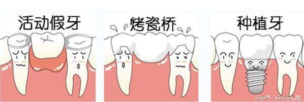 孩子玩闹时把大门牙磕掉了怎么办,十岁孩子门牙磕掉一块该怎么治疗