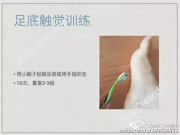 扁平足矫正训练法,扁平足物理治疗能不能恢复足弓