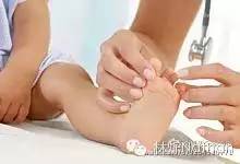 扁平足矫正训练法,扁平足物理治疗能不能恢复足弓