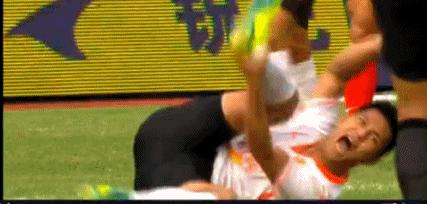 足坛断腿骨头外露,中国足球铲断腿