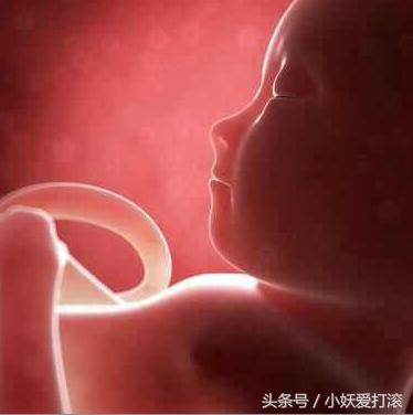 31周+3破水,医院保胎18天,宝宝4斤9两希望健康早点出院