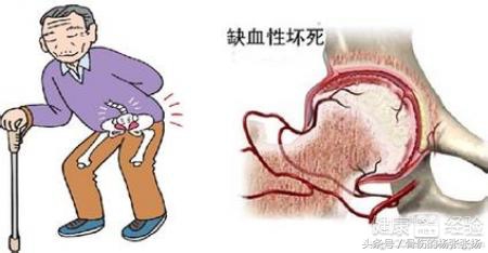 5类疾病要特别警惕,5类人需要特别注意癌症