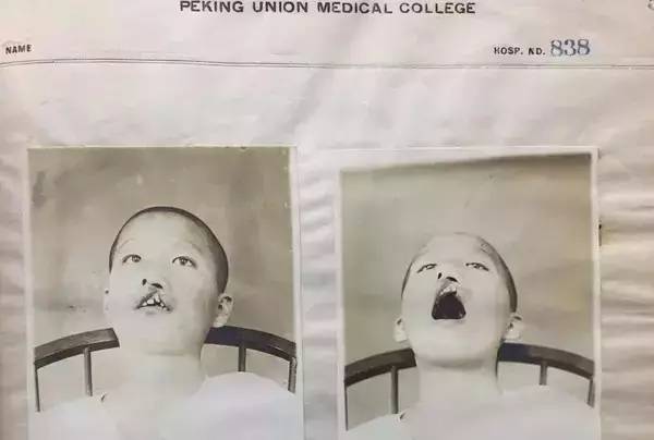 协和的医生有多牛,协和医院有多牛图片