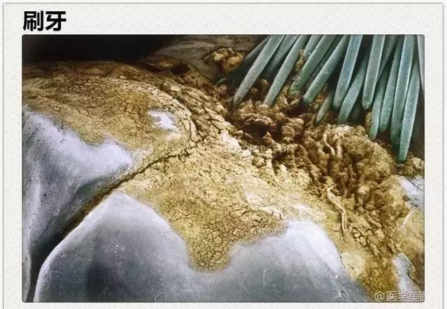 牙医能辨别出换过没换过的牙齿吗,牙医见过最好的牙齿是怎么样的