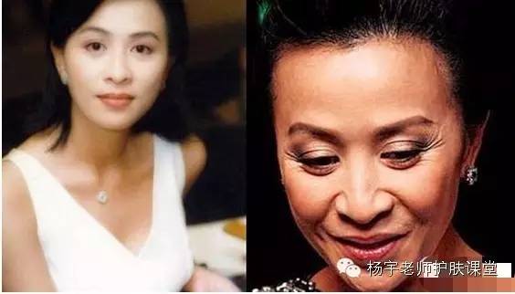 一招搞定松弛面部,脸部防松弛推荐