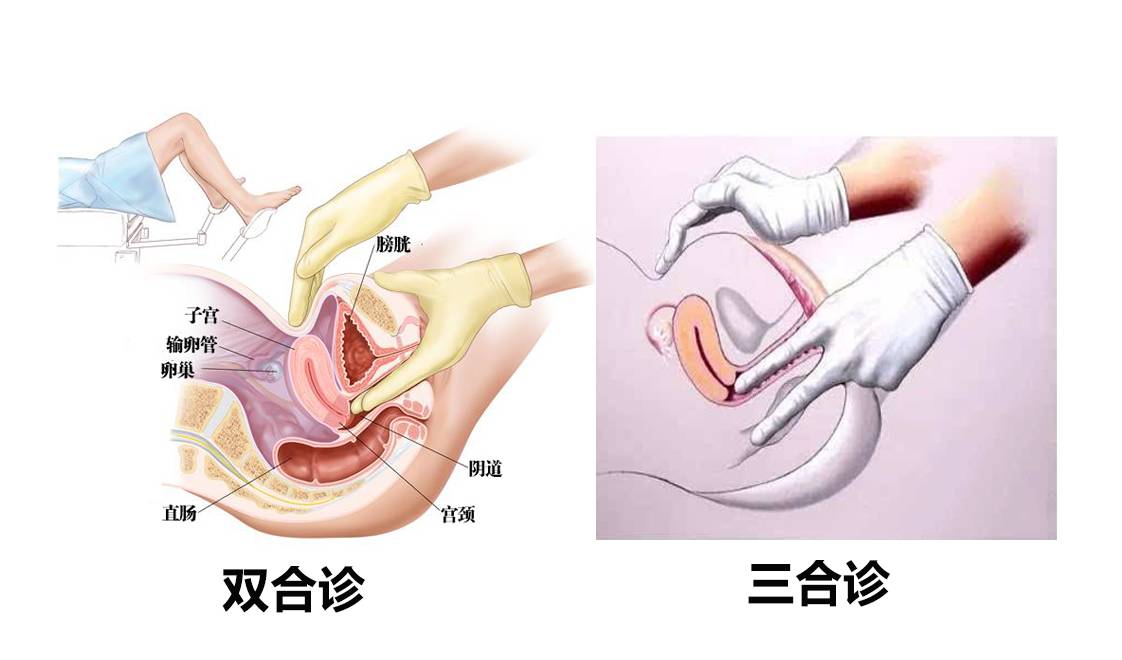 女人每年体检必须要做的项目,女性各年龄段必做的体检项目