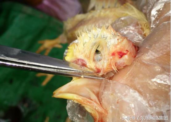 感冒和腺肌胃炎的混感治疗方案