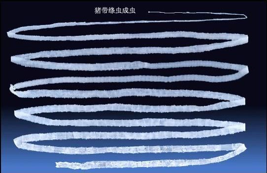 男子被吃脑虫入侵20天后病逝，提醒：这几种常见寄生虫得小心