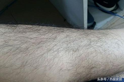 腿毛多的男的说明什么,腿毛多的男人是什么意思