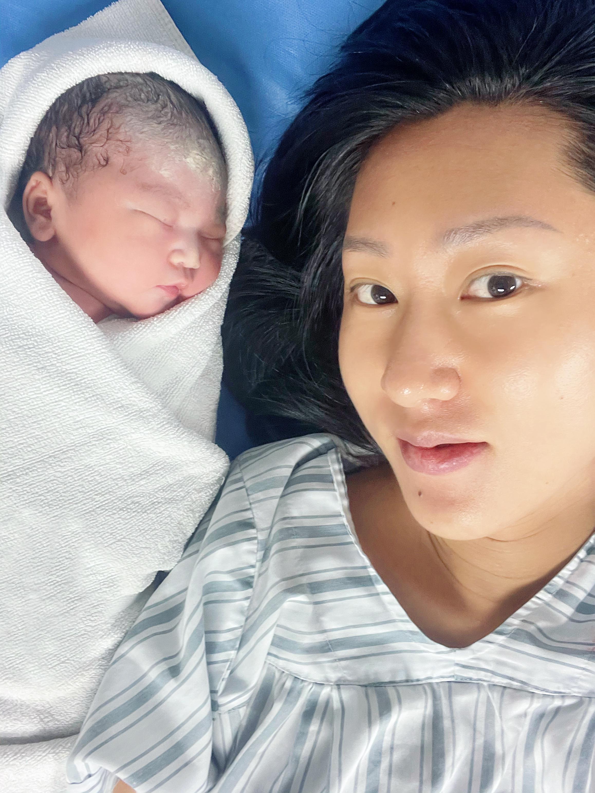 宝宝出生才16天黄疸怎么又反复了,当孩子出生后黄疸了妈妈最心疼