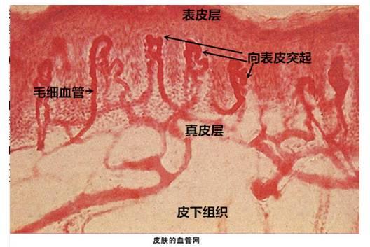 去除高原红红血丝最快的方法,怎么区分高原红和红血丝