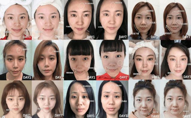 科颜氏抗初老精华露元气弹,科颜氏小白瓶跟元气弹