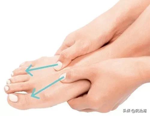 腰椎间盘突出全国有多少人,腰椎间盘突出别担心90%都能恢复