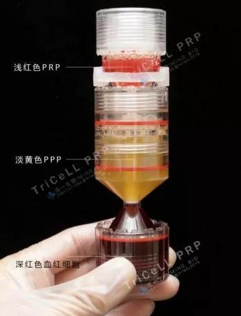 明星如何保持年轻抗衰老,明星童颜美容术好吗