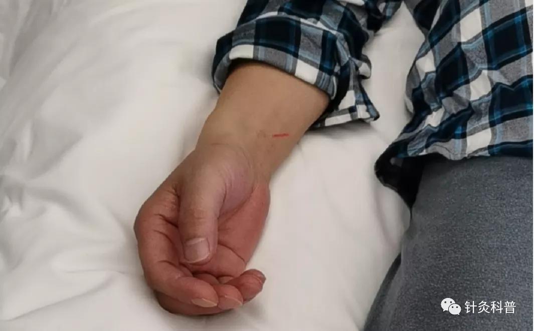 针灸治疗颈椎病视频全集,颈椎病针灸下针手法视频