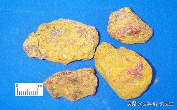 杀虫止痒的内服中药配方,中药杀虫燥湿止痒药