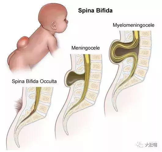 最好的叶酸是什么品牌,老年人吃叶酸哪个品牌最好