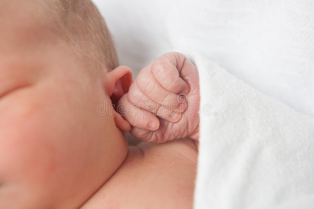 婴儿为什么有胎记,婴儿胎记大全图解