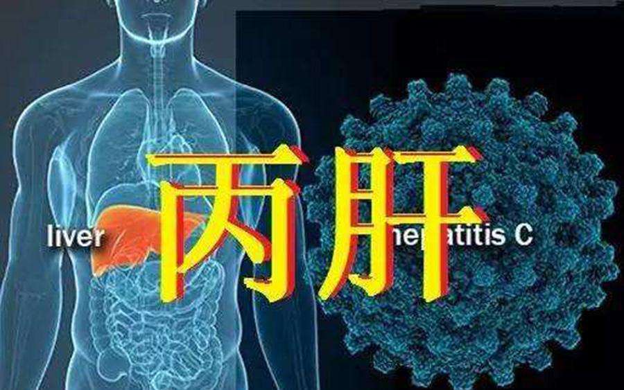 吉利德丙肝神药,吉利德公司丙肝新药价格