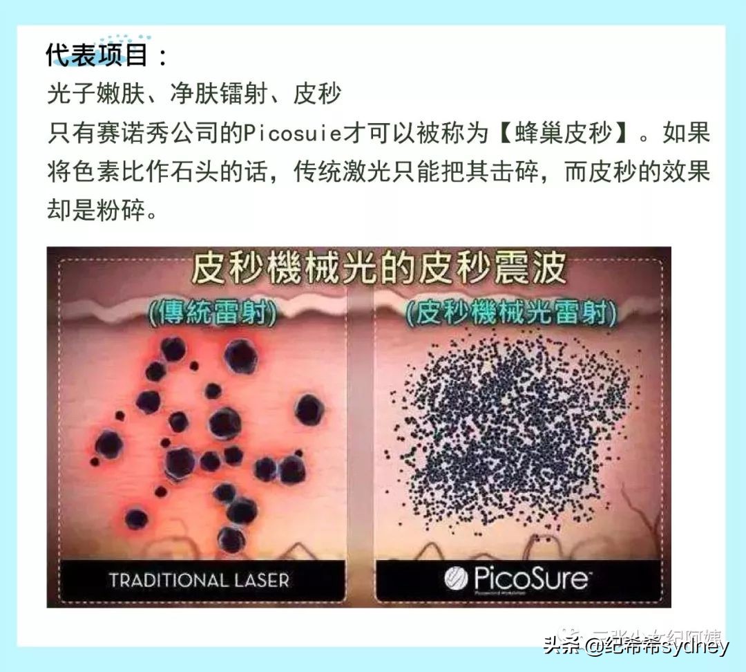 卡戴珊詹娜医美,卡戴珊太后医美