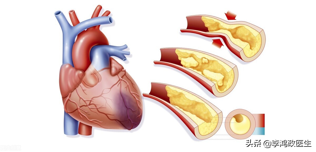 郭美美减肥药事件的最终处理结果,郭美美减肥药品