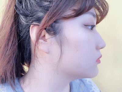 片仔癀痘痘贴解救痘痘,片仔癀祛痘印最有效的方法