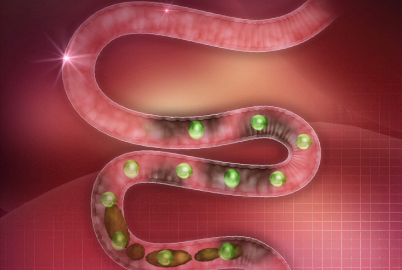 人体内真有6公斤宿便吗？怎么才能排出那些“赖着不走”的宿便？