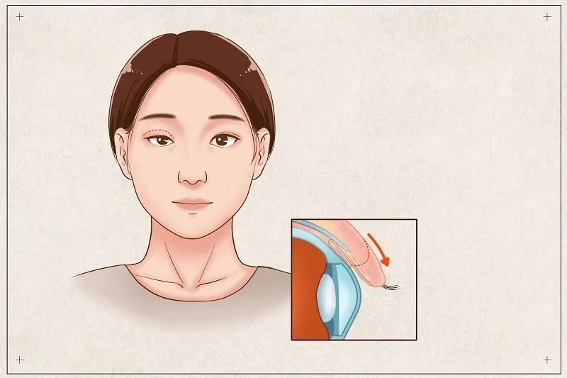 3岁小孩平时爱挑眉、耸肩，医生却说不是坏习惯？